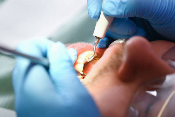 Best Tooth Infection Emergency Dentist  in Mansura, LA