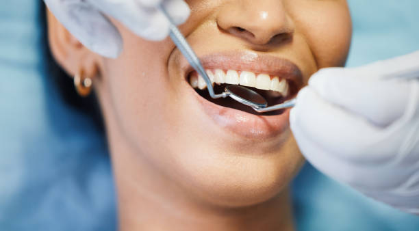 Best Walk-In Dentist Near Me  in Mansura, LA